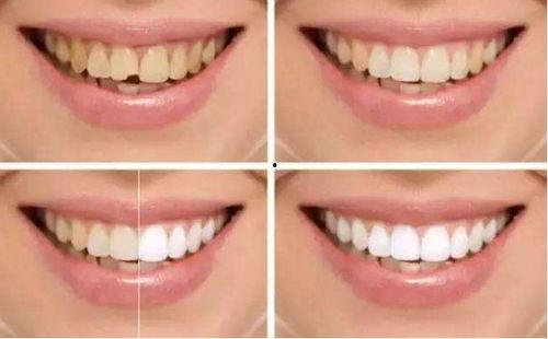 明星牙齿整齐,揭秘牙齿整齐的秘密